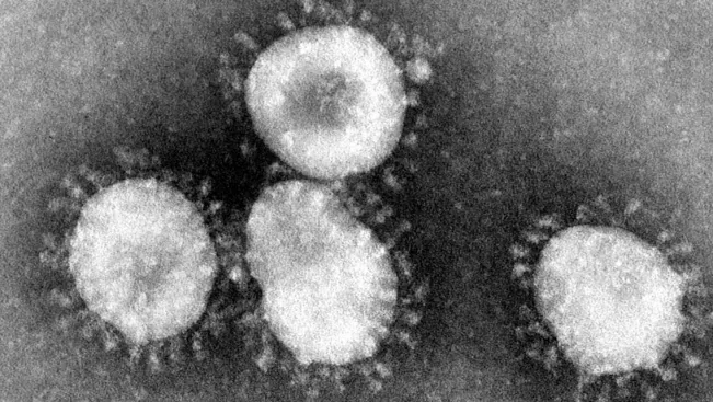 coronaviruses_wikicommons_1975_phil_ID_4814_public_domain.jpg (DE)